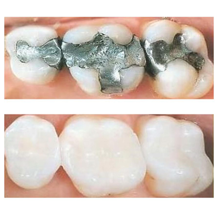 Allcare Dental Centre In 4 118 120 Longueville Rd Lane Cove Nsw 2066 Whereis