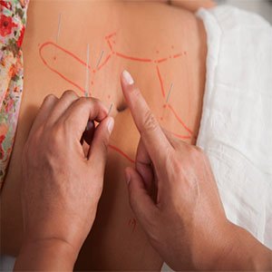 Daniel Song He - Acupuncture - 1 Alconah St - Sunnybank