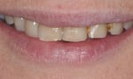 GoldCity Dental Centre - Pic 5