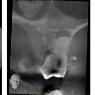 Clayray Dental Radiology - Pic 3