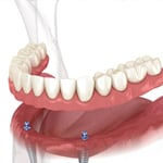 Geelong Denture Care Centre - Pic 7