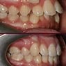 Capital Smiles Orthodontist - Pic 7
