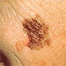 Port Macquarie Skin Cancer Clinic - Pic 5