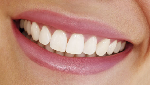 Be proud of your smile.