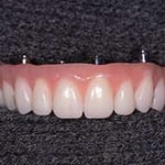 Tas Denture Studios - Pic 9