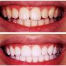 Dental On Metro - Pic 7