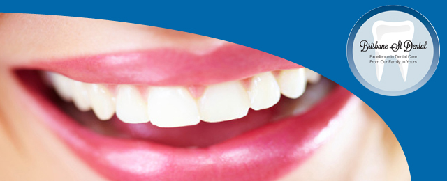 Brisbane St Dental - Promotion 2