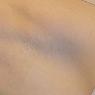 Geelong Hair Removal - Hair Removal - 219 Pakington St 