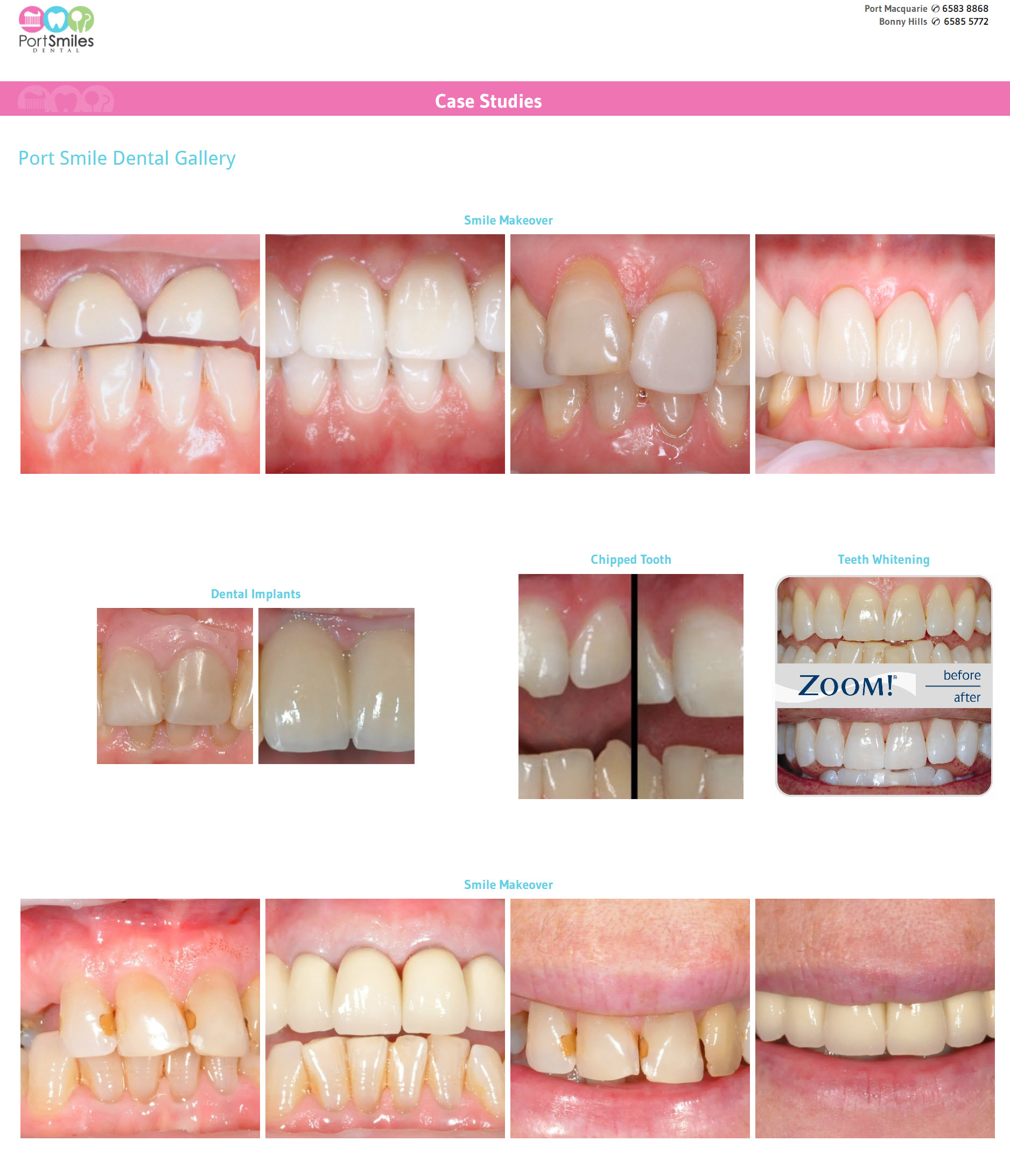 Port Smiles - Case Studies