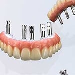Tas Denture Studios - Pic 5