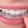 Brudenell, Sugiarto & Huang Orthodontists - Pic 3