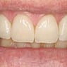 Drummoyne Laser Dental - Pic 1
