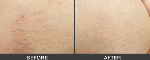 South Coast Skin & Vein Clinic - Pic 5