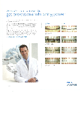 Teeth Whitening