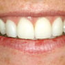 Drummoyne Laser Dental - Pic 4