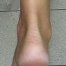 Lake Macquarie Podiatry - Pic 10