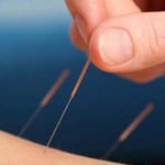 Bon Acupuncture Clinic - Pic 4