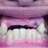 Affordable Denture Clinic - Pic 5