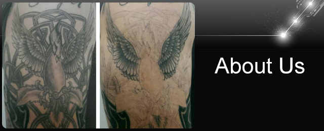 laser pro tattoo removal tattoo removal 16a addison st laser pro tattoo removal tattoo removal 16a addison st