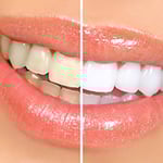 Dental Plus - Pic 6