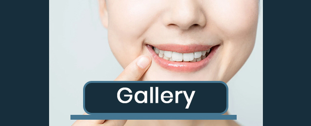 Geelong Denture Care Centre - Promotion 3