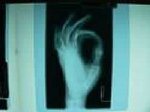 Peel Peninsula Chiropractic - Pic 4