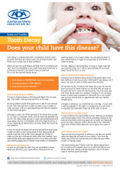 Tooth Decay