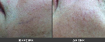 South Coast Skin & Vein Clinic - Pic 8