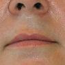 Geelong Hair Removal - Pic 10