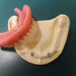 Ask us about the benefits of having implant retained dentures, particularly for full lower dentures.