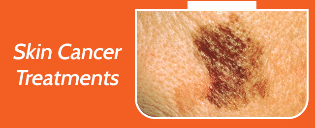 Port Macquarie Skin Cancer Clinic - Promotion 3