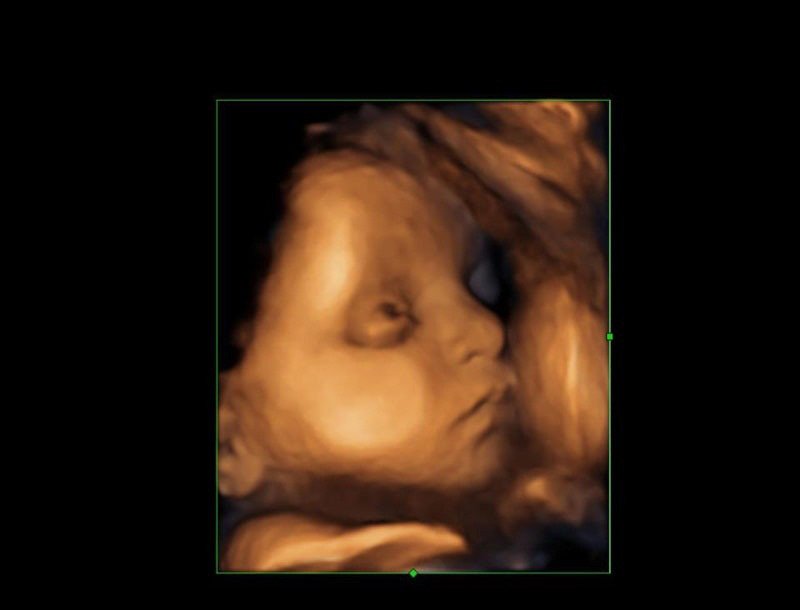 Penrith Ultrasound For Women Doctors Medical Practitioners PO Box