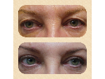 www.cosmeticsurgeryqld.com.au