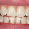 Drummoyne Laser Dental - Pic 9