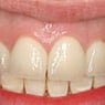 Drummoyne Laser Dental - Pic 6