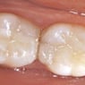 Drummoyne Laser Dental - Pic 2