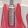South Coast City Dental - Pic 6
