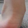 Lake Macquarie Podiatry - Pic 4