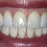 Drummoyne Laser Dental - Pic 7