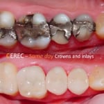 Sundial Dental Laurieton - Pic 2