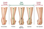 All Podiatry Services - Pic 5