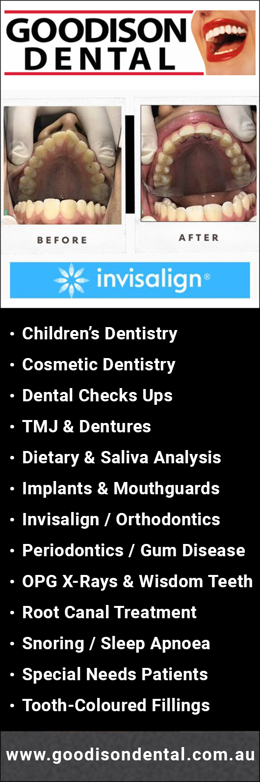 Goodison Dental Services - Promotion