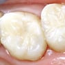Drummoyne Laser Dental - Pic 3