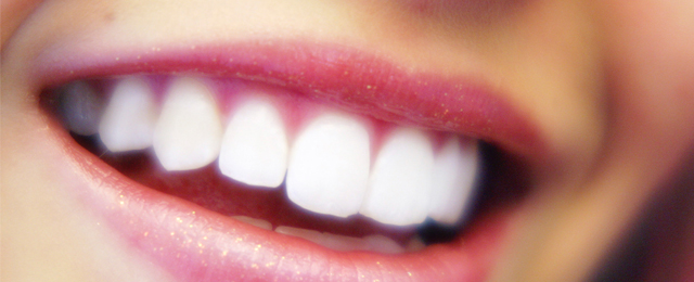 Smile Dental Mosman Park - Promotion 2
