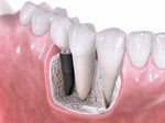 Advance Dental Services - Pic 3
