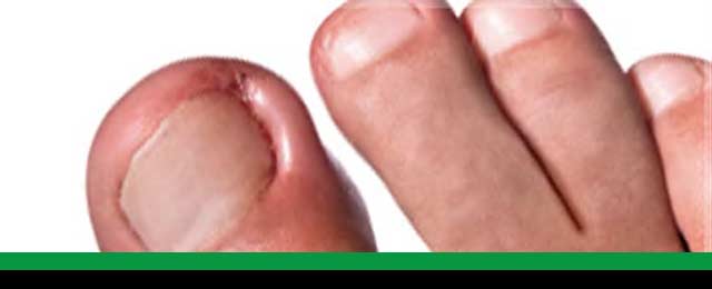 The Foot and Ankle Clinic - Promotion 2