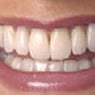 Drummoyne Laser Dental - Pic 10