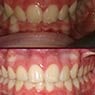 Capital Smiles Orthodontist - Pic 6