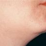 Geelong Hair Removal - Pic 5