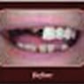 Affordable Denture Clinic - Pic 7